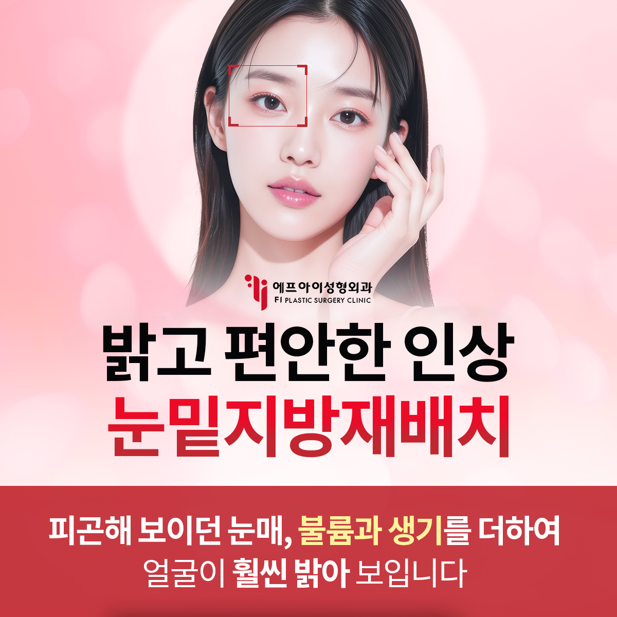 압구정 눈밑 지방재배치